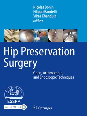 cover image of Hip Preservation Surgery